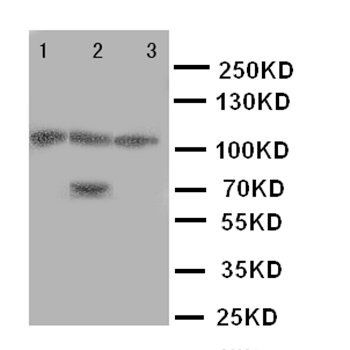 Anti-SERCA1 ATPase/ATP2A1 Antibody