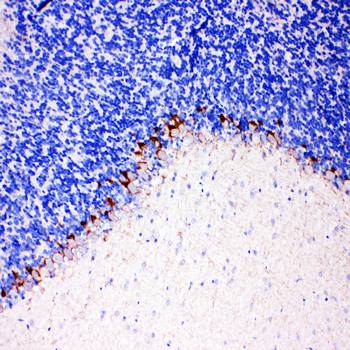 Anti-GABA Transporter 1/GAT 1/SLC6A1 Antibody