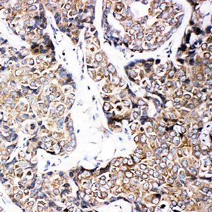 Anti-ABCB6 Antibody