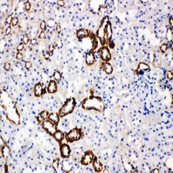 Glucose Transporter 5 GLUT5/SLC2A5 Antibody