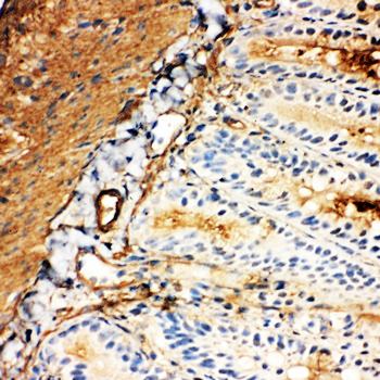 Anti-Glucose Transporter 5 GLUT5/SLC2A5 Antibody