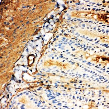 Glucose Transporter 5 GLUT5/SLC2A5 Antibody