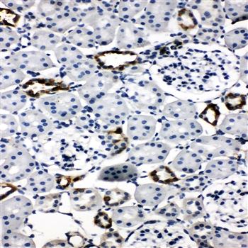 Anti-Aquaporin 2/AQP2 Antibody