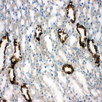 Anti-Aquaporin 2/AQP2 Antibody
