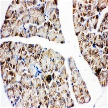 Anti-IGF1 Receptor/IGF1R Antibody
