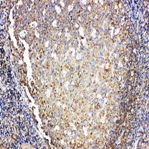 Anti-Interleukin-4 IL4 Antibody