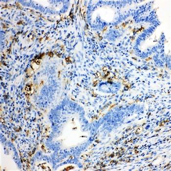 Anti-TRPC6 Antibody