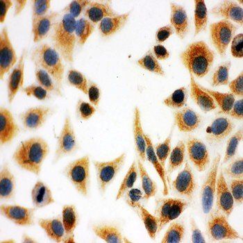 Anti-DCI/ECI1 Antibody