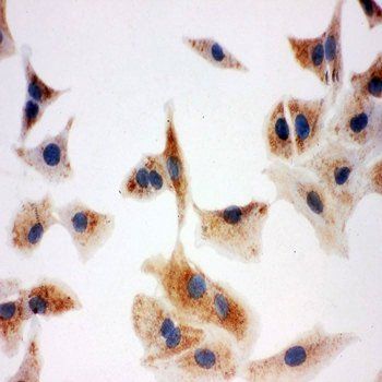 Anti-DCI/ECI1 Antibody