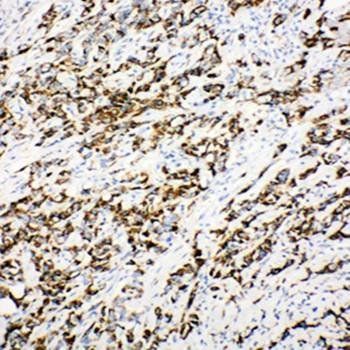 Anti-DCI/ECI1 Antibody