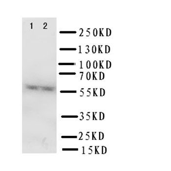 FMO3 Rabbit Polyclonal Antibody