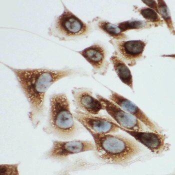 Kallikrein 6/KLK6 Rabbit Polyclonal Antibody