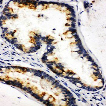 Kallikrein 6/KLK6 Rabbit Polyclonal Antibody