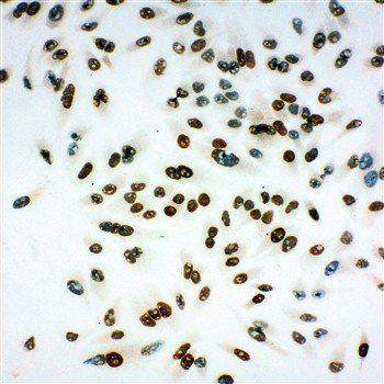 Anti-MCM6 Antibody
