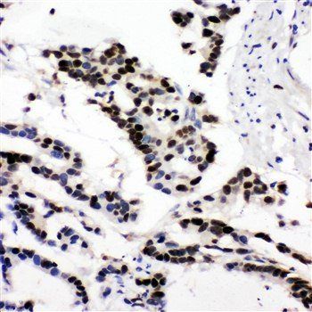 Anti-MCM6 Antibody