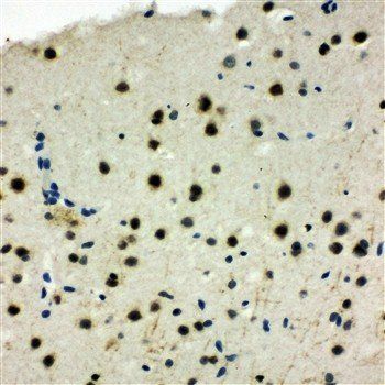 Anti-MCM6 Antibody