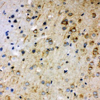 Anti-Rab5/RAB5A Antibody