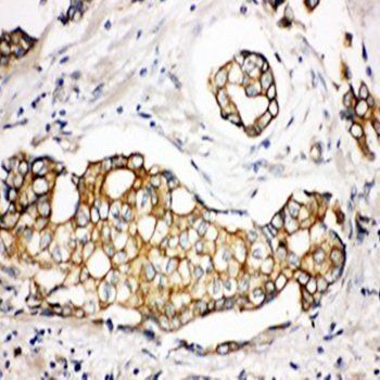 Serine palmitoyltransferase 1 SPTLC1 Rabbit Polyclonal Antibody