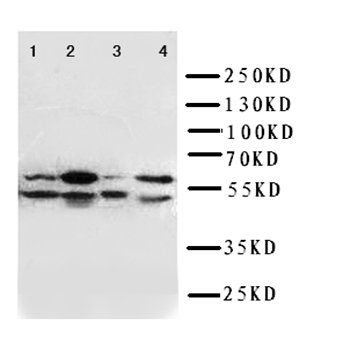 Serine palmitoyltransferase 1 SPTLC1 Rabbit Polyclonal Antibody