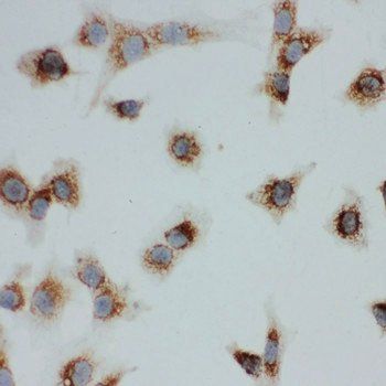 Anti-VDAC/Porin/VDAC1 Antibody