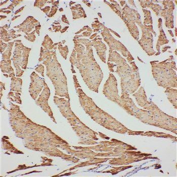 Anti-VDAC/Porin/VDAC1 Antibody