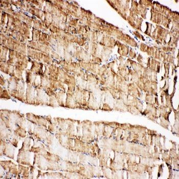 Anti-VDAC/Porin/VDAC1 Antibody
