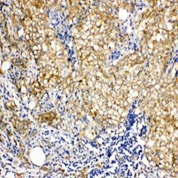 Anti-Vinculin/VCL Antibody