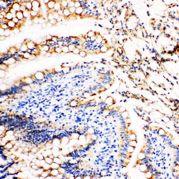 Vinculin/VCL Antibody