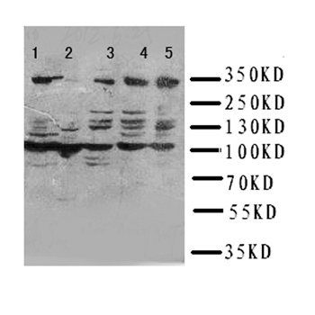 Serine-protein kinase ATM ATM Antibody