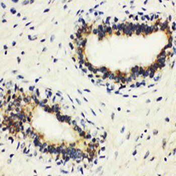 HLA DMB/HLA-DMB Rabbit Polyclonal Antibody