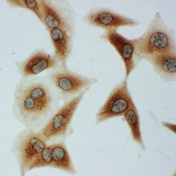 Anti-Grp75/HSPA9 Antibody