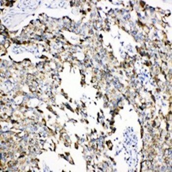 Anti-Grp75/HSPA9 Antibody