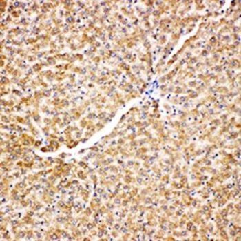 Anti-Grp75/HSPA9 Antibody