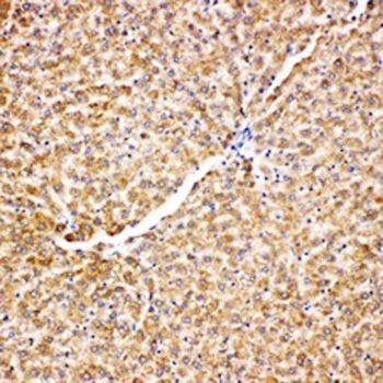 Grp75/HSPA9 Antibody