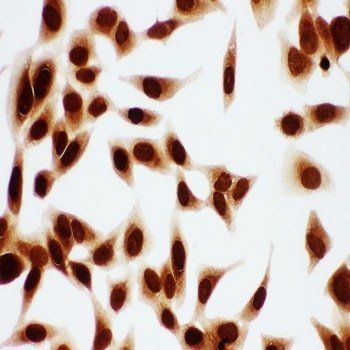 Anti-MCM7 Antibody