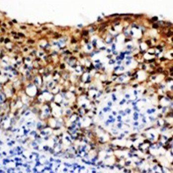 Anti-14-3-3 sigma/SFN Antibody