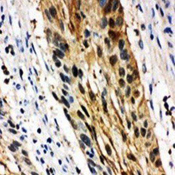 Anti-14-3-3 sigma/SFN Antibody