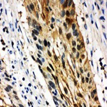 Anti-14-3-3 sigma/SFN Antibody