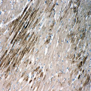 Anti-Heat shock protein beta-2 HSPB2 Antibody