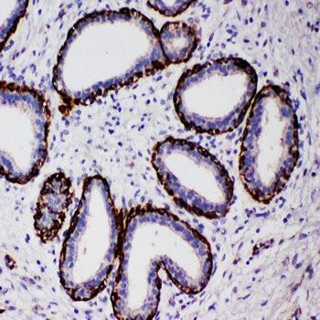 Anti-Arginase-2, mitochondrial Arg2 Antibody
