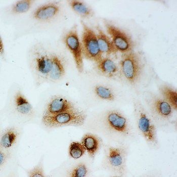 Anti-Hsp70/HSPA1A/HSPA1B Antibody