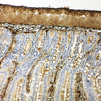 Hsp70/HSPA1A/HSPA1B Antibody