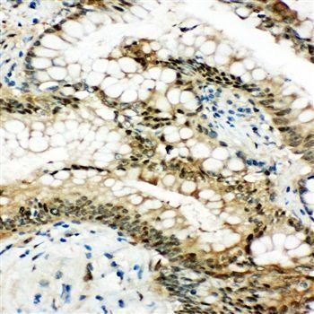 Anti-Hsp70/HSPA1A/HSPA1B Antibody