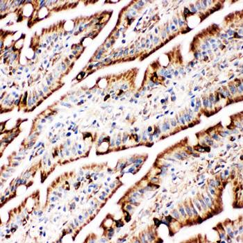 GRP78 BiP/HSPA5 Antibody