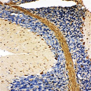 Anti-GRP78 BiP/HSPA5 Antibody