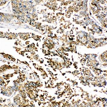 Anti-GRP78 BiP/HSPA5 Antibody