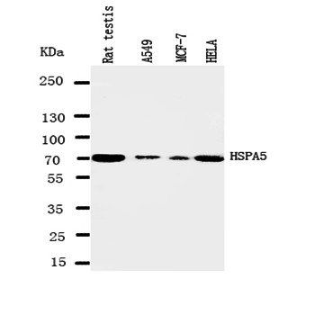 Anti-GRP78 BiP/HSPA5 Antibody