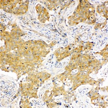 Anti-Hsc70/HSPA8 Antibody