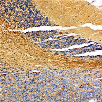 Anti-NM23A/NME1 Antibody