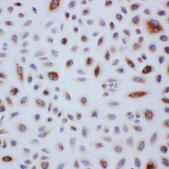 Anti-Peroxiredoxin 3/PRDX3 Antibody